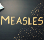 מגפת החצבת: איך משתלטים על זה?-תמונה